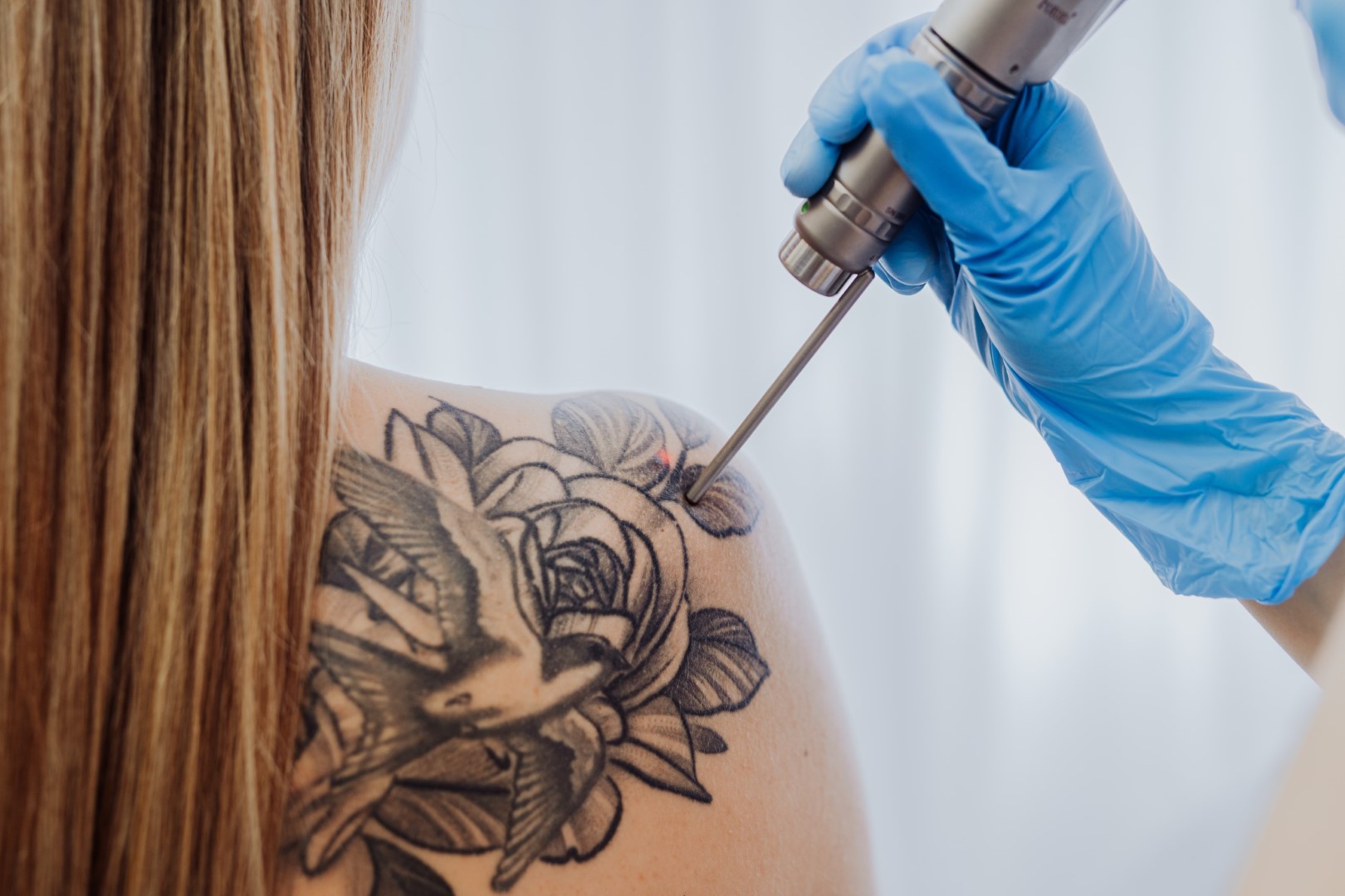 LASEROWE USUWANIE TATUAŻY